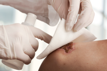 The Wound Pros